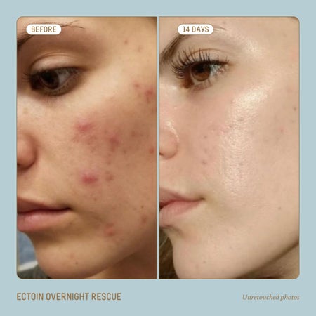 Squalane + Ectoin Overnight Rescue Image 4