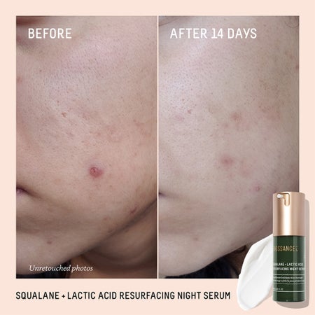 Squalane + 10% Lactic Acid Resurfacing Serum Image 3